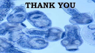 Hydatidosis- Echinococcus granulosus