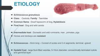 ETIOLOGY
 Echinococcus granulosus
 Class : Cestoda, Family : Taeniidae
 Common Name : Dwarf tapeworm of dog, Hydatidosis
 Final host : Dog and wild canids
 Intermediate host : Domestic and wild ruminants, man , primates, pigs
 Horses and donkeys are resistant
 Echinococcus – 6mm long – Consist of scolex and 3-4 segments- terminal –gravid
 Hydatid Cyst : large fluid-filled vesicles, 5-10cm diameter, concentrically laminated cuticle
and germinal layer.
 