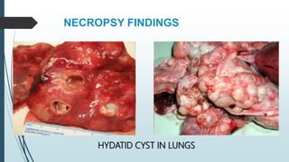 NECROPSY FINDINGS
HYDATID CYST IN LUNGS
 