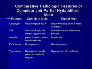 Comparative Pathologic Features ofComparative Pathologic Features of
Complete and Partial HydatidiformComplete and Partial Hydatidiform
MoleMole
FeatureFeature Complete MoleComplete Mole Partial MolePartial Mole
KaryotypeKaryotype Usually diploid 46XXUsually diploid 46XX Usually triploidy 69XXX mostUsually triploidy 69XXX most
common.common.
VilliVilli All villi hydropin; noAll villi hydropin; no
normal adjacent villinormal adjacent villi
Normal adjacent villi may beNormal adjacent villi may be
presentpresent
vesselsvessels present they contain nopresent they contain no
fetal blood cellsfetal blood cells
blood cellsblood cells
Fetal tissueFetal tissue None presentNone present Usually presentUsually present
TrophoblastTrophoblast Hyperplasia usuallyHyperplasia usually
present to variablepresent to variable
degreesdegrees
Hyperplasia mild and focalHyperplasia mild and focal
 