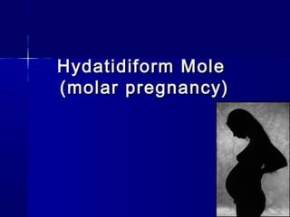 Hydatidiform MoleHydatidiform Mole
(molar pregnancy)(molar pregnancy)
 