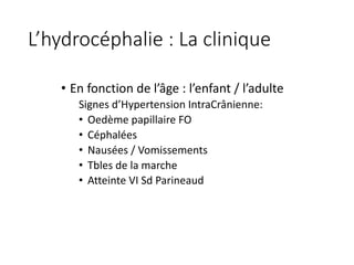 L’hydrocéphalie	:	La	clinique	
• En	fonction	de	l’âge	:	l’enfant	/	l’adulte	
Signes	d’Hypertension	IntraCrânienne:
• Oedème	papillaire	FO
• Céphalées
• Nausées	/	Vomissements
• Tbles	de	la	marche
• Atteinte	VI	Sd	Parineaud
 