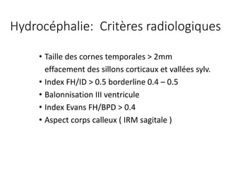 • Taille des	cornes temporales >	2mm
effacement	des	sillons corticaux et	vallées sylv.
• Index	FH/ID	>	0.5	borderline	0.4	– 0.5
• Balonnisation III	ventricule
• Index	Evans	FH/BPD	>	0.4
• Aspect	corps	calleux (	IRM	sagitale )
Hydrocéphalie:		Critères radiologiques
 