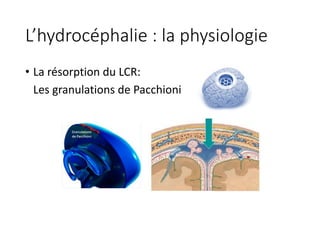 L’hydrocéphalie	:	la	physiologie
• La	résorption	du	LCR:		
Les	granulations	de	Pacchioni
 