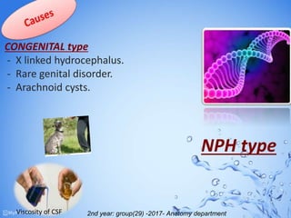 CONGENITAL type
- X linked hydrocephalus.
- Rare genital disorder.
- Arachnoid cysts.
Viscosity of CSF
NPH type
2nd year: group(29) -2017- Anatomy department
 