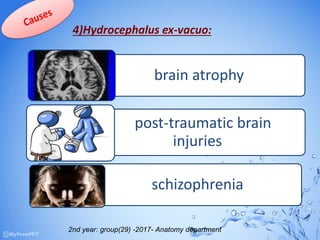 4)Hydrocephalus ex-vacuo:
brain atrophy
post-traumatic brain
injuries
schizophrenia
2nd year: group(29) -2017- Anatomy department
 