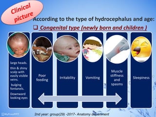 According to the type of hydrocephalus and age:
 Congenital type (newly born and children )
large heads.
thin & shiny
scalp with
easily visible
veins.
bulging
fontanels.
Downward
looking eyes
Poor
feeding
Irritability Vomiting
Muscle
stiffness
and
spasms
Sleepiness
2nd year: group(29) -2017- Anatomy department
 