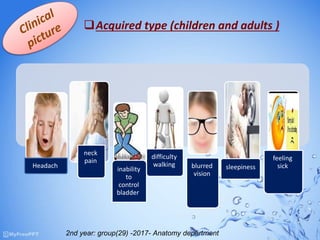 Headach
neck
pain
inability
to
control
bladder
difficulty
walking blurred
vision
sleepiness
feeling
sick
Acquired type (children and adults )
2nd year: group(29) -2017- Anatomy department
 