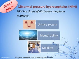 NPH has 3 sets of distinctive symptoms
it affects:-
Urinary system
Mental ability
Mobility
Normal pressure hydrocephalus (NPH)
2nd year: group(29) -2017- Anatomy department
 
