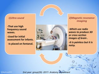 1)Ultra sound
-That use high
frequency sound
waves.
-Used for initial
assessment for infants.
-Is placed on fontanal.
2)Magnetic resonance
imagimg
-Which use radio
waves to produce 3D
or cross section
images of brain .
-It is painless but it is
noisy.
2nd year: group(29) -2017- Anatomy department
 