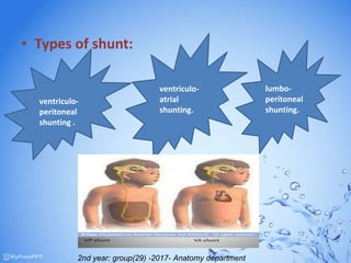 • Types of shunt:
ventriculo-
peritoneal
shunting .
ventriculo-
atrial
shunting.
lumbo-
peritoneal
shunting.
2nd year: group(29) -2017- Anatomy department
 