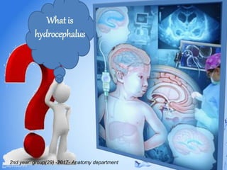 What is
hydrocephalus
2nd year: group(29) -2017- Anatomy department
 