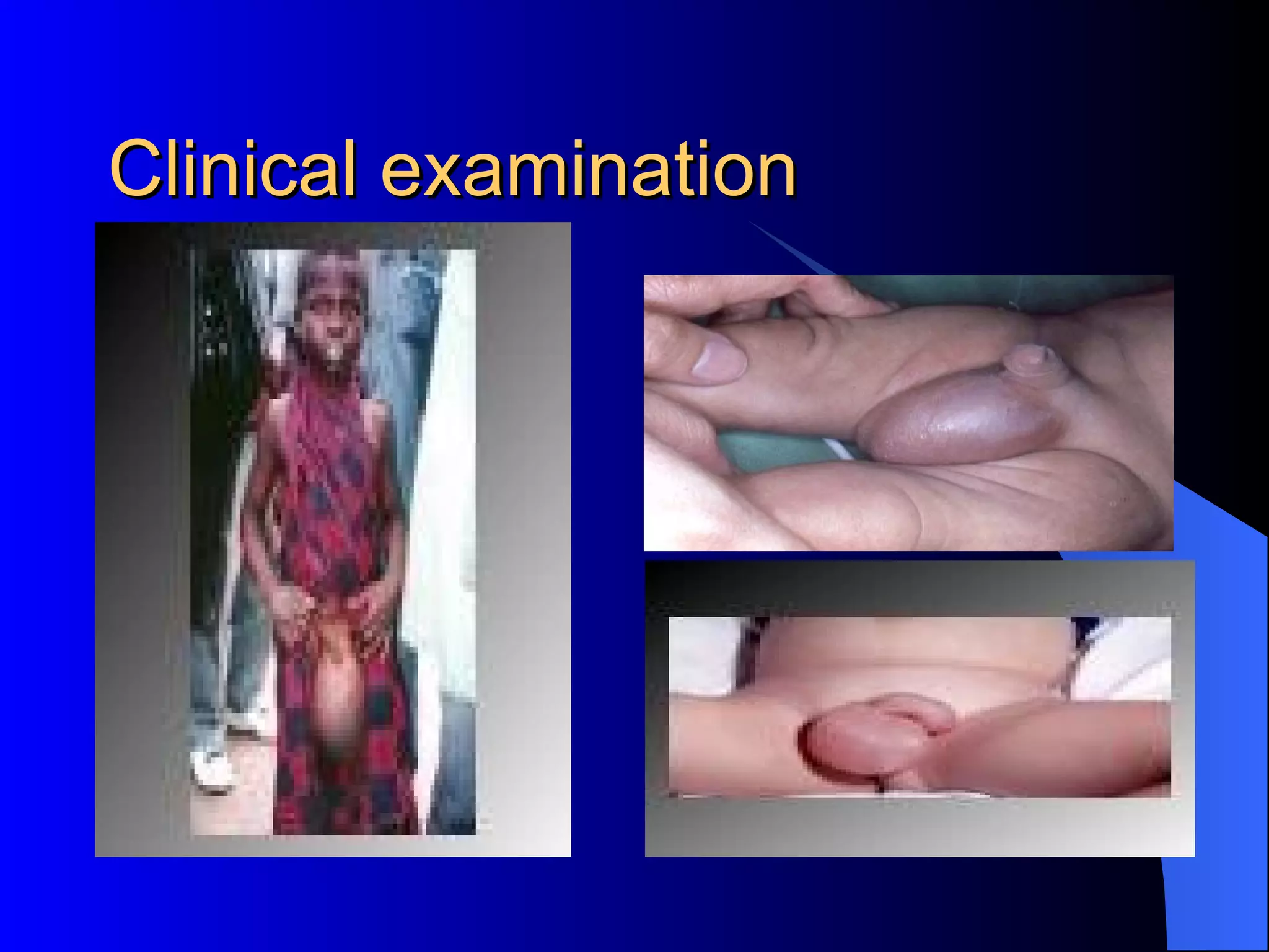 Clinical examination