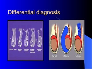 Differential diagnosis 