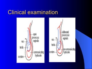 Clinical examination 