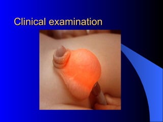 Clinical examination 