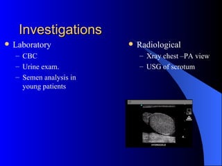 Investigations Laboratory CBC Urine exam. Semen analysis in young patients Radiological Xray chest –PA view USG of scrotum 