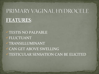 FEATURES:
TESTIS NO PALPABLE
FLUCTUANT
TRANSILLUMINANT
CAN GET ABOVE SWELLING
TESTICULAR SENSATION CAN BE ELICITED