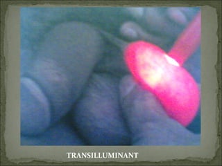 TRANSILLUMINANT