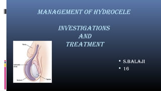 ManageMent of hydrocele 
investigations 
and 
treatMent 
 s.balaji 
 16 
 