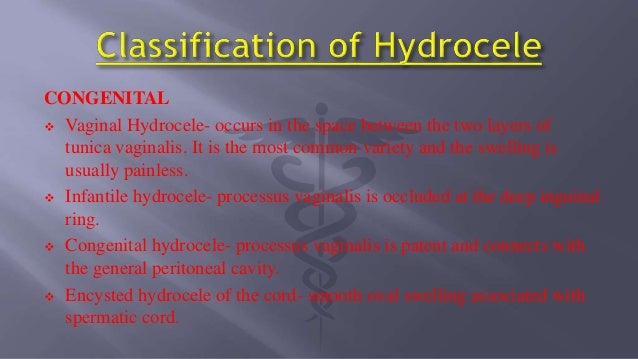 Hydrocele