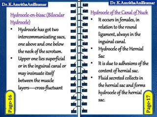 Hydrocele-en-bisac(Bilocular
Hydrocele)
• Hydrocele has got two
intercommunicating sacs,
one aboveand one below
the neck of the scrotum.
• Upper one lies superficial
or in the inguinal canal or
may insinuateitself
betweenthe muscle
layers—cross-fluctuant
Hydrocele of the Canal of Nuck
• It occurs in females, in
relationto the round
ligament, alwaysin the
inguinal canal.
• Hydrocele of theHernial
Sac
• It is due to adhesions of the
content of hernial sac.
• Fluidsecreted collects in
the hernial sac and forms
hydrocele of the hernial
sac.
 