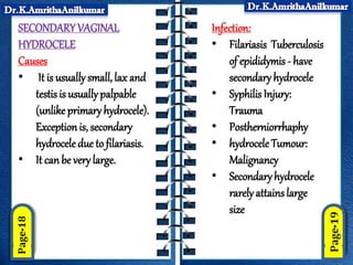 SECONDARYVAGINAL
HYDROCELE
Causes
• It is usually small, lax and
testis is usually palpable
(unlike primary hydrocele).
Exceptionis, secondary
hydrocele due to filariasis.
• It can be very large.
Infection:
• Filariasis Tuberculosis
of epididymis - have
secondary hydrocele
• Syphilis Injury:
Trauma
• Postherniorrhaphy
• hydrocele Tumour:
Malignancy
• Secondaryhydrocele
rarely attains large
size
 