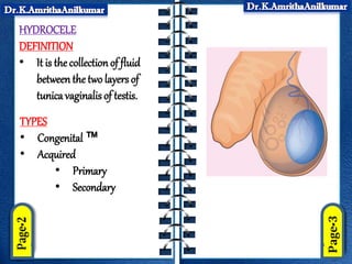 HYDROCELE
DEFINITION
• It is the collectionof fluid
betweenthe two layersof
tunica vaginalis of testis.
TYPES
• Congenital ™
• Acquired
• Primary
• Secondary
 