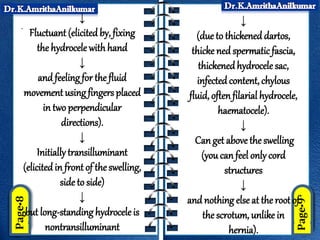 .
↓
Fluctuant (elicited by, fixing
the hydrocele with hand
↓
and feeling for the fluid
movement using fingers placed
in two perpendicular
directions).
↓
Initially transilluminant
(elicited in front of the swelling,
side to side)
↓
but long-standing hydrocele is
nontransilluminant
↓
(due to thickened dartos,
thicke ned spermaticfascia,
thickenedhydrocele sac,
infected content, chylous
fluid, oftenfilarial hydrocele,
haematocele).
↓
Canget abovethe swelling
(you can feel only cord
structures
↓
and nothing else at the root of
the scrotum, unlike in
hernia).
 