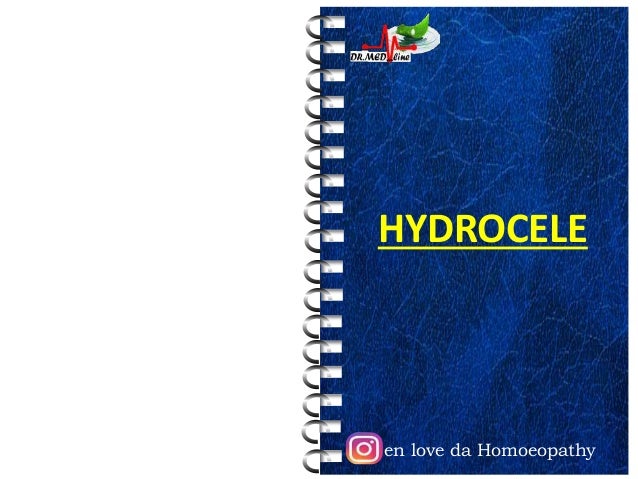 Hydrocele by Dr.K.AmrithaAnilkumar 2 hydrocele by drkamrithaanilkumar 1 638