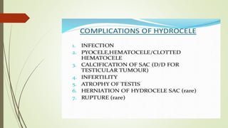 Hydrocele.pptx