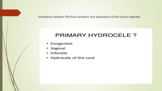 Imbalance between the fluid secretion and absorption of the tunica vaginalis
 