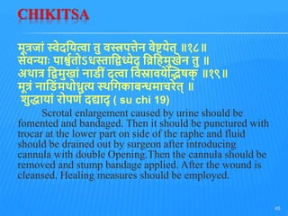 CHIKITSA
मूत्रजाुं स्वेदतयत्वा िु वस्त्रपत्तेन वेष्टयेि् ॥१८॥
सेवन्ाोः पाश्वभिोऽधस्तातिध्येद् तव्रतिमुेेन िु ॥
अथात्र तिमुेाुं नाडीुं दत्वा तवस्रावयेद्धिषक
् ॥१९॥
मूत्रुं नातडुंमथोध्रुत्य स्थतगकाबन्धमाचरेि् ॥
शुिायाुं रोपणुं दद्याद् ( su chi 19)
Scrotal enlargement caused by urine should be
fomented and bandaged. Then it should be punctured with
trocar at the lower part on side of the raphe and fluid
should be drained out by surgeon after introducing
cannula with double Opening.Then the cannula should be
removed and stump bandage applied. After the wound is
cleansed. Healing measures should be employed.
45
 