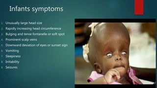 Infants symptoms
1. Unusually large head size
2. Rapidly increasing head circumference
3. Bulging and tense fontanelle or soft spot
4. Prominent scalp veins
5. Downward deviation of eyes or sunset sign
6. Vomiting
7. Sleepiness
8. Irritability
9. Seizures
 
