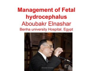 Management of Fetal hydrocephalus Aboubakr Elnashar Benha university Hospital, Egypt 
Aboubakr Elnashar 
 