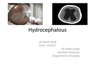 Hydrocephalous
UG Batch-2018
Date- 15/9/21
Dr. Ankita Singh
Assistant Professor
Department of Surgery
 