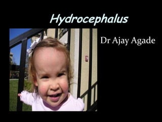 Hydrocephalus
        Dr Ajay Agade
 