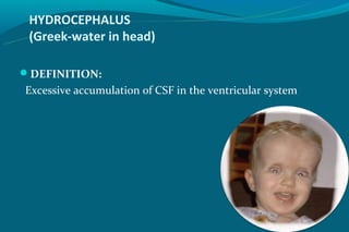 HYDROCEPHALUS
 (Greek-water in head)

DEFINITION:
Excessive accumulation of CSF in the ventricular system
 