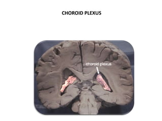CHOROID PLEXUS
 