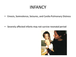 INFANCY
• Emesis, Somnolence, Seizures, and Cardio Pulmonary Distress
• Severely affected infants may not survive neonatal period
 