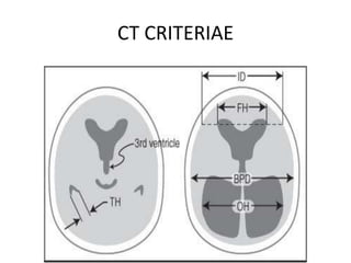 CT CRITERIAE
 