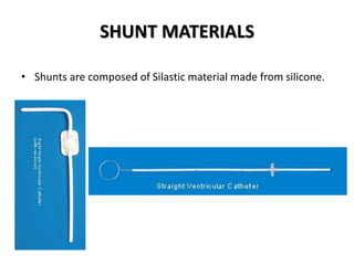 SHUNT MATERIALS
• Shunts are composed of Silastic material made from silicone.
 