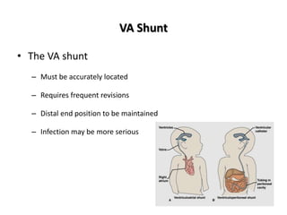 VA Shunt
• The VA shunt
– Must be accurately located
– Requires frequent revisions
– Distal end position to be maintained
– Infection may be more serious
 