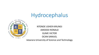 Hydrocephalus
NTONDE USHER KIRUNGI
AMODOI RONALD
GUME VICTOR
OCAN SAMUEL
Mbarara University of Science and Technology
 
