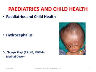 PAEDIATRICS AND CHILD HEALTH
• Paediatrics and Child Health
• Hydrocephalus
Dr. Chongo Shapi (BSc.HB, MBChB)
- Medical Doctor
3/29/2022 Dr. Chongo Shapi, BSc.HB, MBChB, CUZ. 1
 