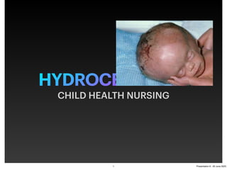 HYDROCEPHALUS
CHILD HEALTH NURSING
1 Presentation 6 - 20 June 2023
 