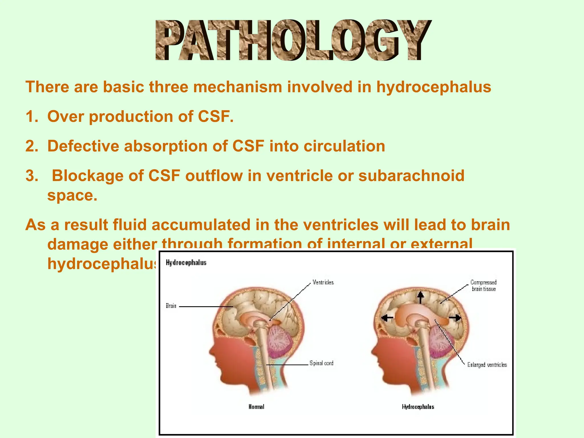 There are basic three mechanism involved in hydrocephalus
1. Over production of CSF.
2. Defective absorption of CSF into circulation
3. Blockage of CSF outflow in ventricle or subarachnoid
space.
As a result fluid accumulated in the ventricles will lead to brain
damage either through formation of internal or external
hydrocephalus
 