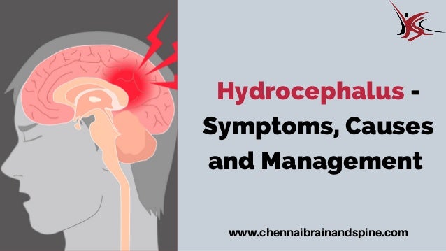 Hydrocephalus - Symptoms, Causes And Management