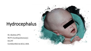 Hydrocephalus
Dr. Akshita (PT)
M.P.T (Cardiopulmonary)
D.C.P.T
Certified BLS & ACLS, AHA
 