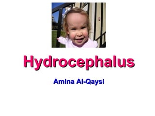 HydrocephalusHydrocephalus
Amina Al-QaysiAmina Al-Qaysi
 